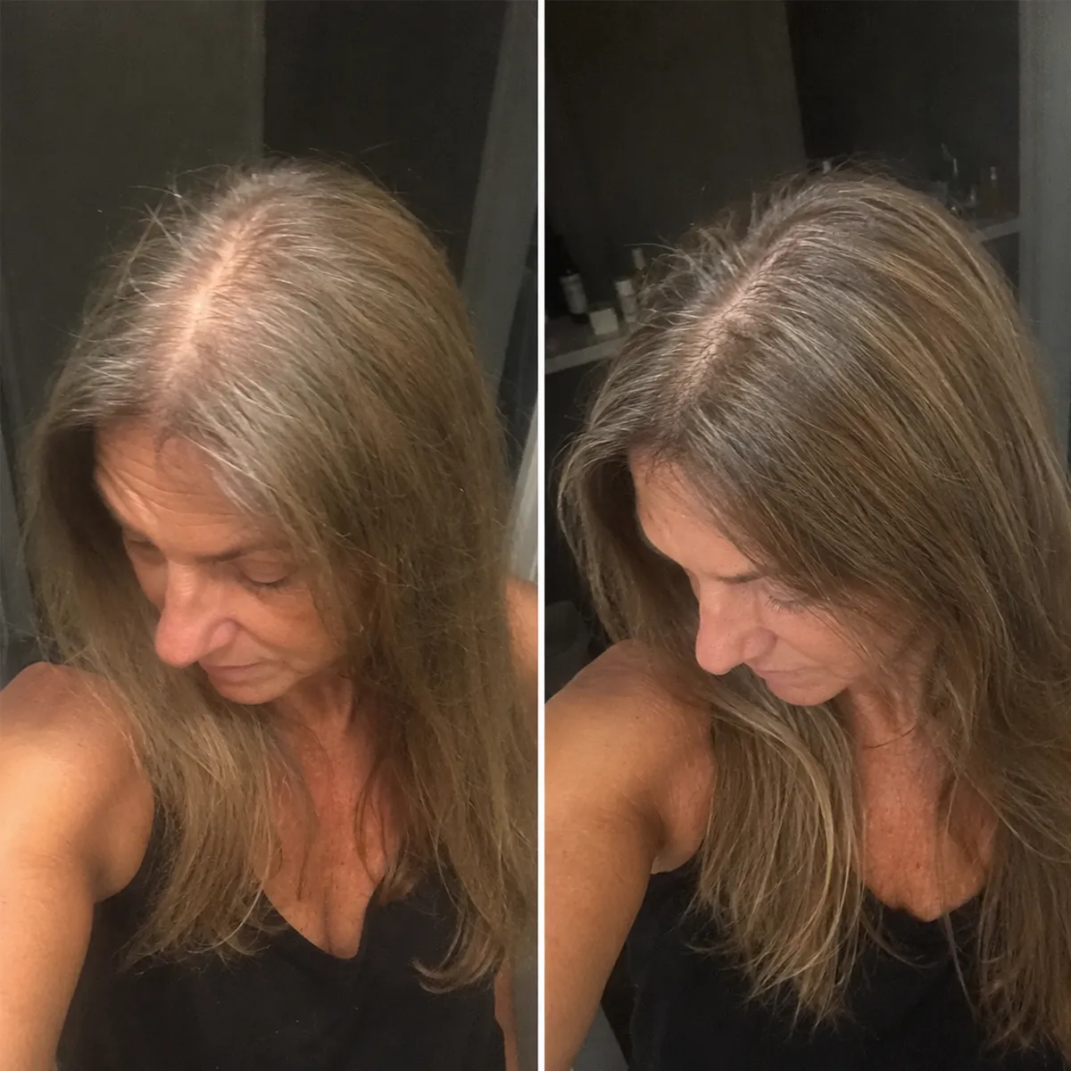 Clientă Folixir reală: cărare lărgită și scalp vizibil, înainte și după utilizarea constantă