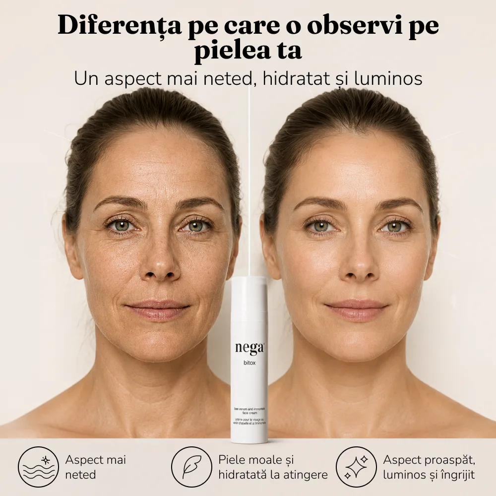 Bitox, cremă cu venin de albine - Image 6